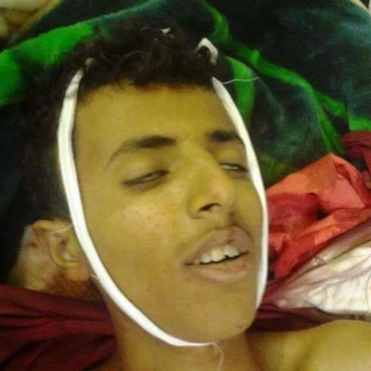 احد الشهداء