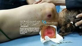 13882414_996671160453891_7333628172962317822_n