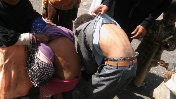 %d8%a7%d8%b7%d9%81%d8%a7%d9%84-%d9%85%d8%b1%d8%b6%d9%89-%d8%a8%d8%a7%d9%84%d8%a7%d9%88%d8%a8%d8%a6%d8%a9